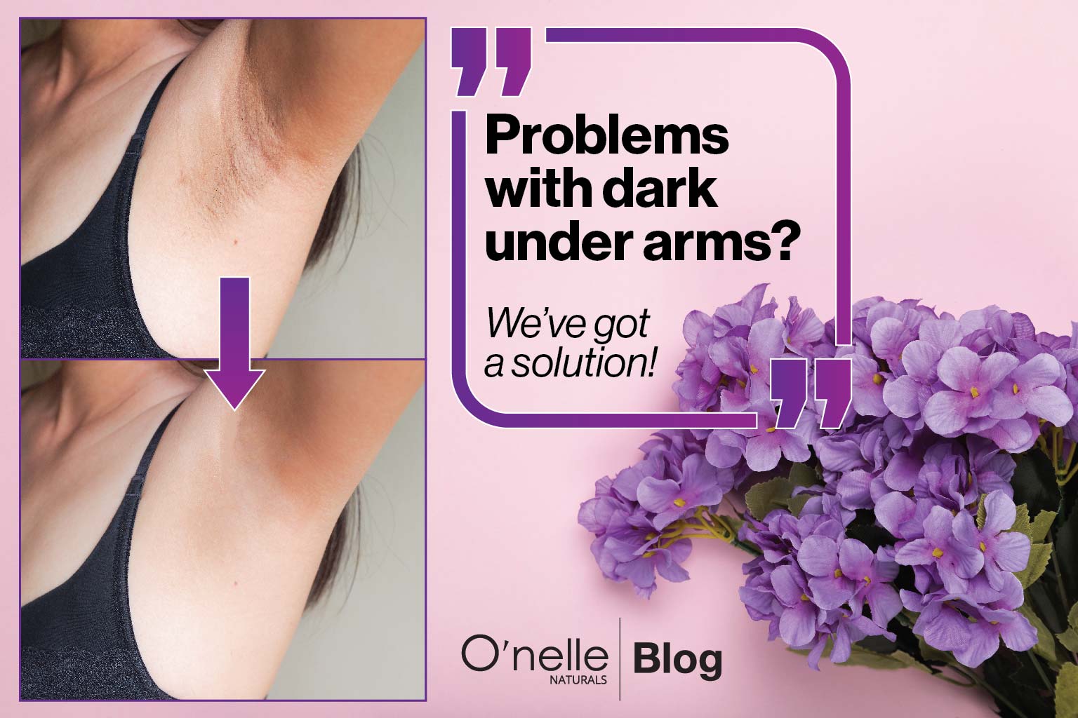 Problems with dark under arms? We've got a solution!