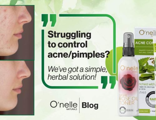 Struggling to control acne? We’ve got a simple, herbal solution!